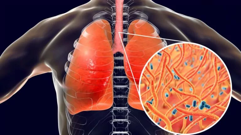 Krztusiec w Europie. Ognisko zachorowań w Chorwacji (FOTOL canva.com)