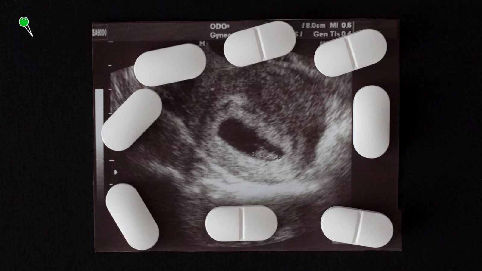 Sejm przeciw ustawie dekryminalizującej aborcję (FOTO: canva.com)