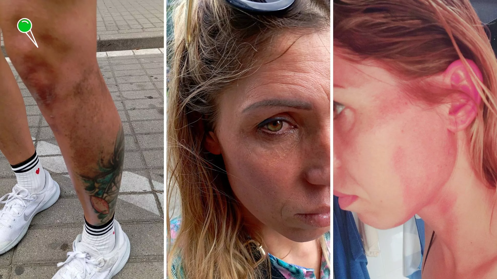 Zofia Klepacka pobita przy Muzeum Powstania Warszawskiego (FOTO: Zofia Klepacka/Facebook)