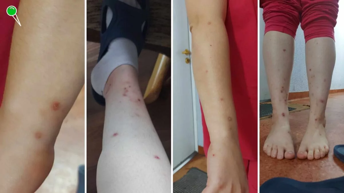 Pokąsani mieszkańcy. Budynek komunalny ul. Ubocze 24 w  Gdańsku (FOTO: mieszkańcy bloku)