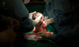 Turcja zakazuje cesarskich cięć bez wskazań medycznych (FOTO: canva)