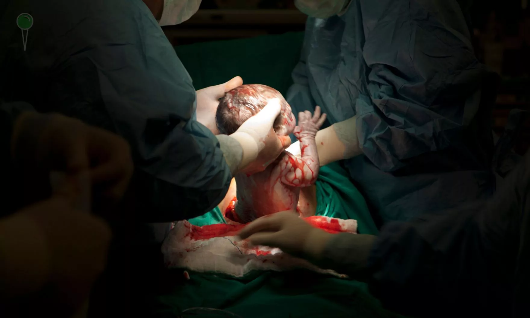 Turcja zakazuje cesarskich cięć bez wskazań medycznych (FOTO: canva)